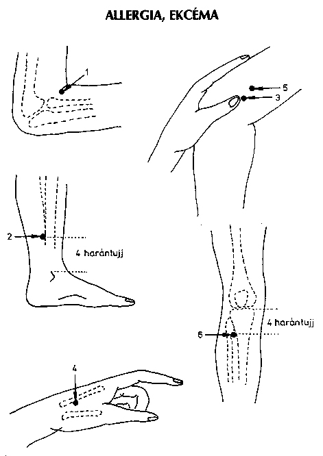 visszér | Kínai-medicina - Akupunktúrás pontok a visszér kezelésére