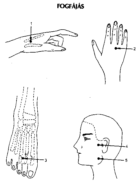 akupunktúrás pont magas vérnyomás esetén)