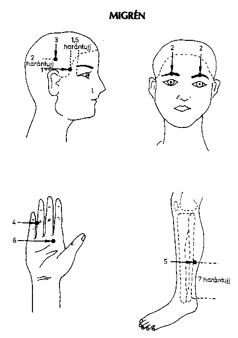 akupunktúrás pontok a testen pdf)