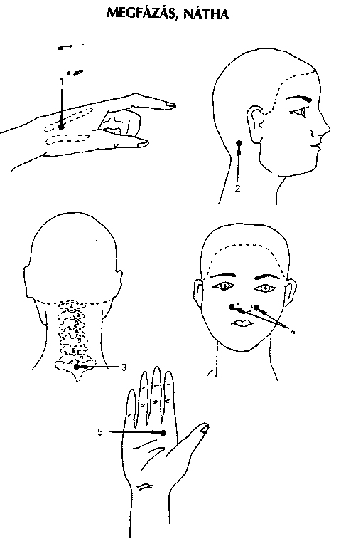 pontok az emberi testen a magas vérnyomástól